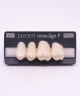 NOVO LIGN P VENEER POST G3 UPPER A1 4 pc