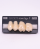 NOVO LIGN P VENEER POST G3 UPPER A2 4 pc