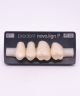 NOVO LIGN P VENEER POST G3 UPPER B1 4 pc