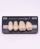 NOVO LIGN P VENEER POST G3 UPPER C1 4 pc