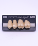 NOVO LIGN P VENEER POST G3 UPPER C4 4 pc