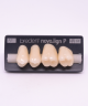 NOVO LIGN P VENEER POST G4 UPPER A2 4 pc