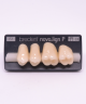 NOVO LIGN P VENEER POST G4 UPPER A3 4 pc