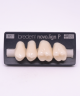 NOVO LIGN P VENEER POST G4 UPPER B1 4 pc