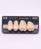 NOVO LIGN P VENEER POST G4 UPPER B2 4 pc