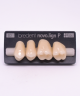 NOVO LIGN P VENEER POST G4 UPPER D2 4 pc