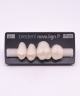 NOVO LIGN P VENEER POST 2W3 UPPER A1 4 pc