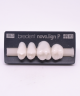 NOVO LIGN P VENEER POST 2W3 UPPER BL3 4 pc