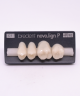 NOVO LIGN P VENEER POST 2W3 UPPER C1 4 pc