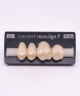 NOVO LIGN P VENEER POST 2W3 UPPER D2 4 pc