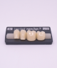 NOVO LIGN P VENEER POST G3 LOWER B2 4 pc