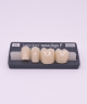 NOVO LIGN P VENEER POST G3 LOWER C1 4 pc