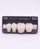 NOVO LIGN P VENEER POST G4 LOWER BL3 4 pc