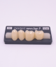 NOVO LIGN P VENEER POST 3W3 LOWER B3 4 pc