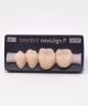 NOVO LIGN P VENEER POST 3W4 LOWER A3 4 pc ASST