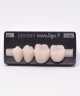 NOVO LIGN P VENEER POST 3W4 LOWER B1 4 pc ASST