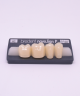 NOVO LIGN P VENEER POST G3 LOWER A2 4 pc