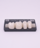 NOVO LIGN P VENEER POST G4 LOWER BL3 4 pc