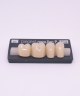 NOVO LIGN P VENEER POST G4 LOWER C1 4 pc