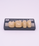 NOVO LIGN P VENEER POST G4 LOWER D4 4 pc