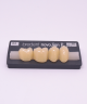 NOVO LIGN P VENEER POST 4W3 LOWER B4 4 pc ASST