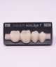 NOVO LIGN P VENEER POST 4W4 LOWER B1 4 pc ASST 