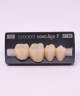 NOVO LIGN P VENEER POST 4W4 LOWER B3 4 pc ASST 