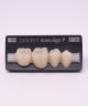 NOVO LIGN P VENEER POST 4W4 LOWER D2 4 pc ASST