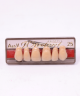 WIEDENT ESTETIC UPPER ANTERIORS SHADE A3.5