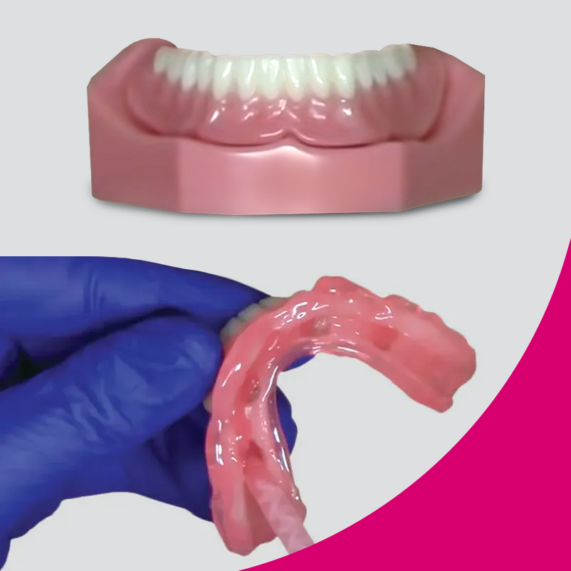LOCATOR ANGLED ABUTMENTS
