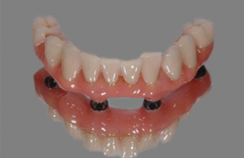 Fast Protec Easy Bar System