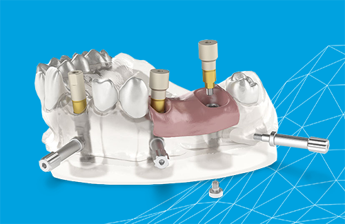 IPD Abutments