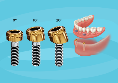Locator Implant Abutments
